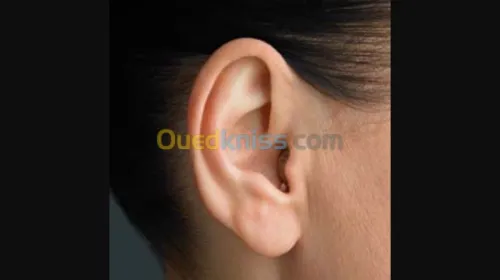 appareil auditif  et audiométrie