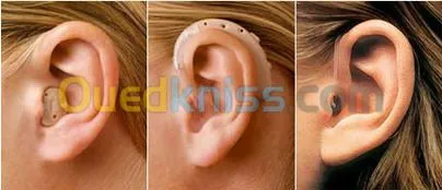 appareil auditif  et audiométrie