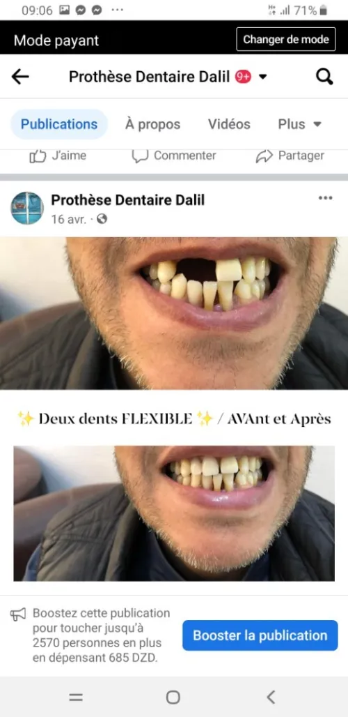 Prothésiste dentaire