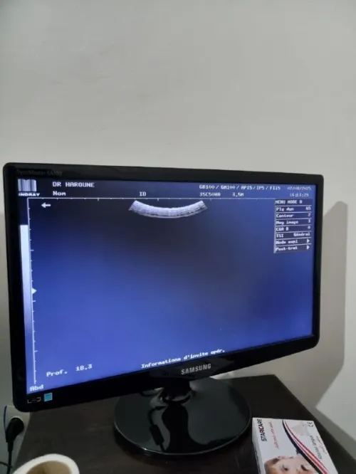 Echographie Mindray 9900