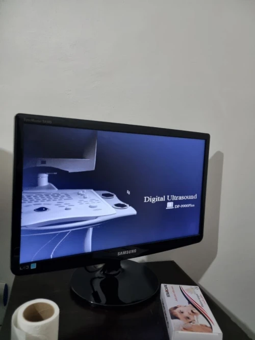 Echographie Mindray 9900