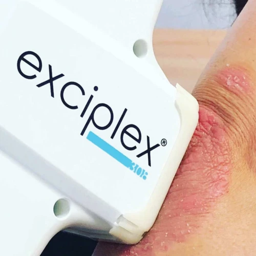 EXCIPLEX - Lampe excimer