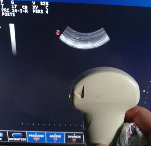 Tout type de Sonde pour échographe