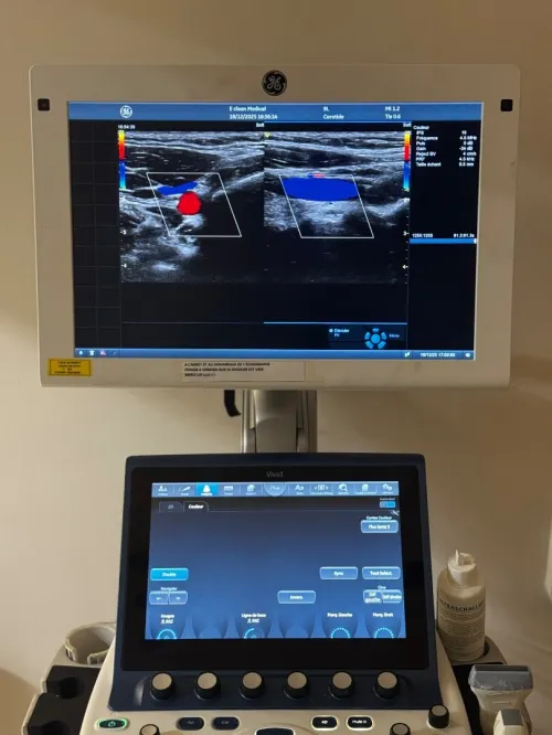 Echographe GE vivid s70 promotion