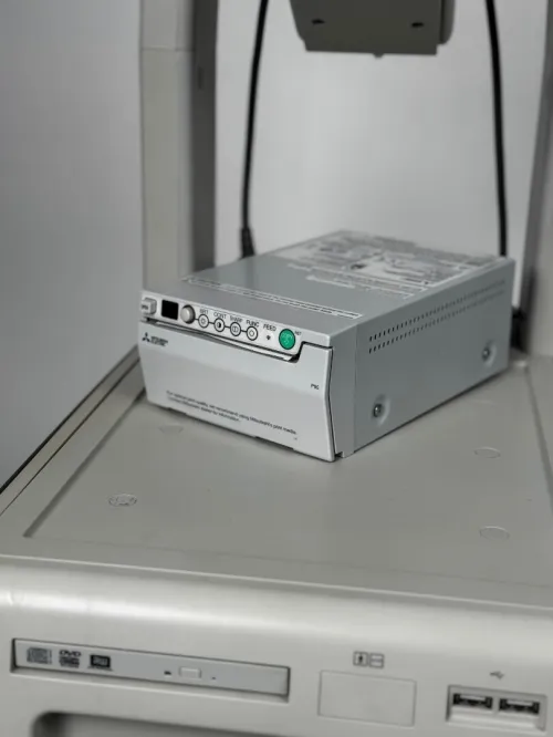ÉCHOGRAPHE TOSHIBA XARIO 200