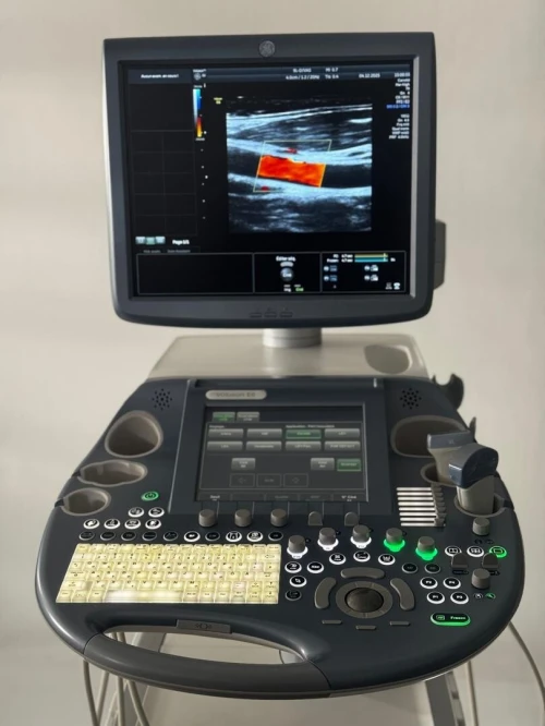 ECHOGRAPHE GE VOLUSON E6