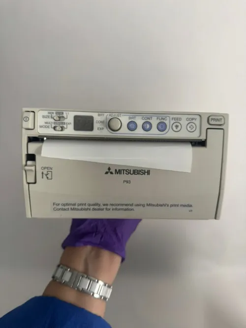 ECHOGRAPHE MEDISON ACCUVIX XG
