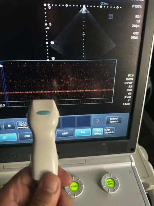 Sonde pour toute Echographe 