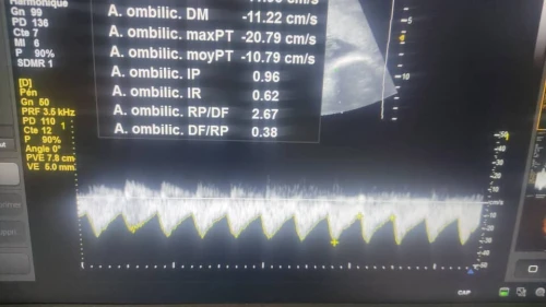échographe Samsung h60 3D/4D