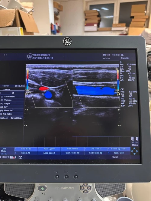 sonde echographe GE 