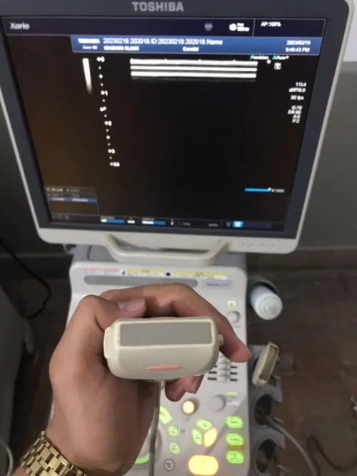 Sonde pour toute Echographe 
