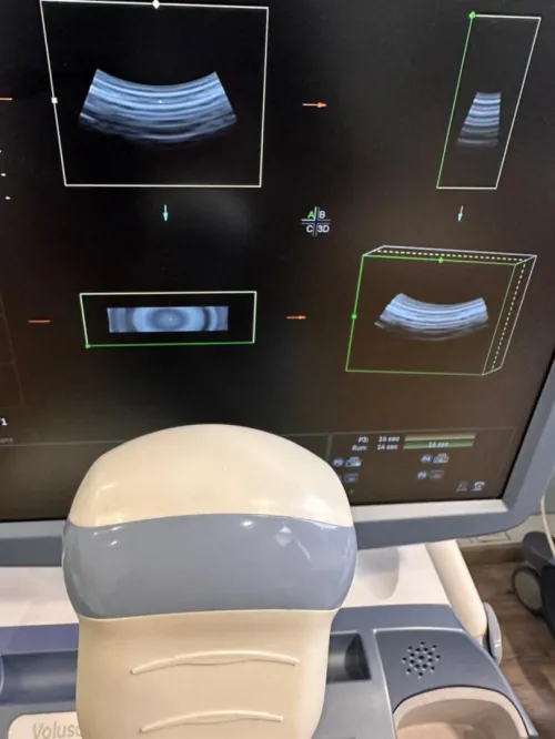 Sonde pour toute Echographe 