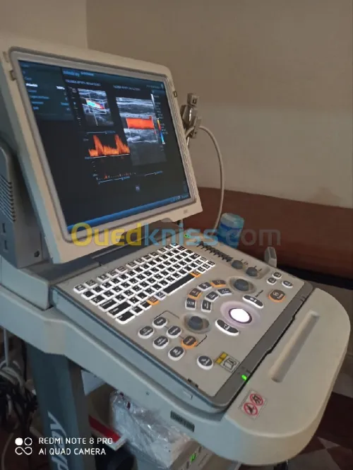 Échographie mindrey Z5 