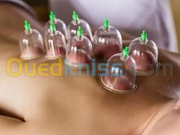 حجامة HIJAMA