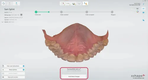 3shape Dental System 2022 + 3Shape Unite 2022 + 3shapeOrtho System 2022 + 3Shape Implant Studio 22 