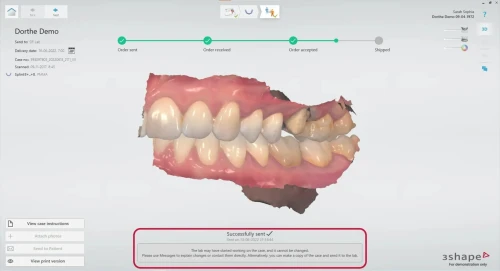 3shape Dental System 2022 + 3Shape Unite 2022 + 3shapeOrtho System 2022 + 3Shape Implant Studio 22 