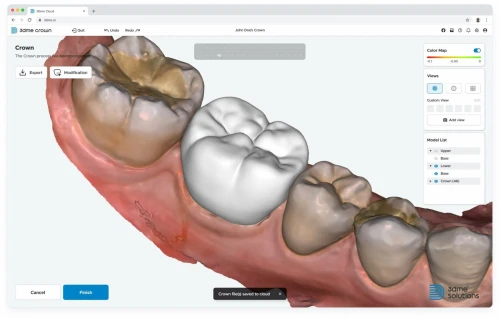 3shape Dental System 2022 + 3Shape Unite 2022 + 3shapeOrtho System 2022 + 3Shape Implant Studio 22 