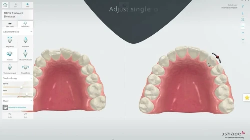 3shape Dental System 2022 + 3Shape Unite 2022 + 3shapeOrtho System 2022 + 3Shape Implant Studio 22 