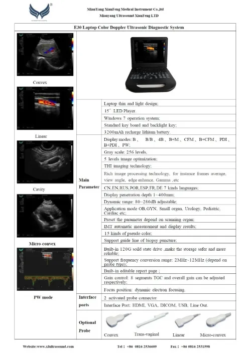 Le plus fiable , le plus rentable l'ECHOGRAPHIE PORTABLE Doppler Couleur XIANFENG E30 