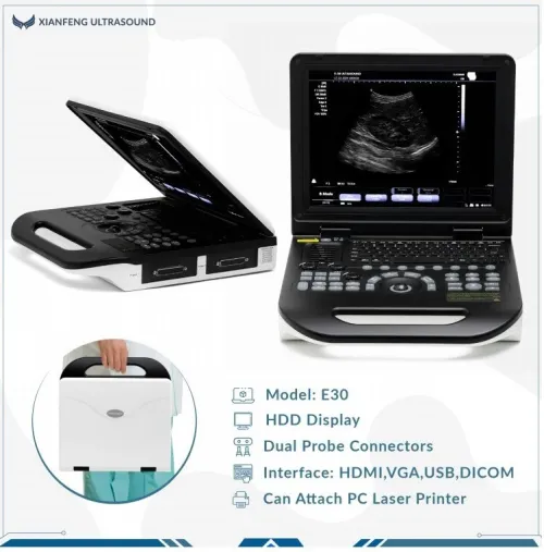 Le plus fiable , le plus rentable l'ECHOGRAPHIE PORTABLE Doppler Couleur XIANFENG E30 