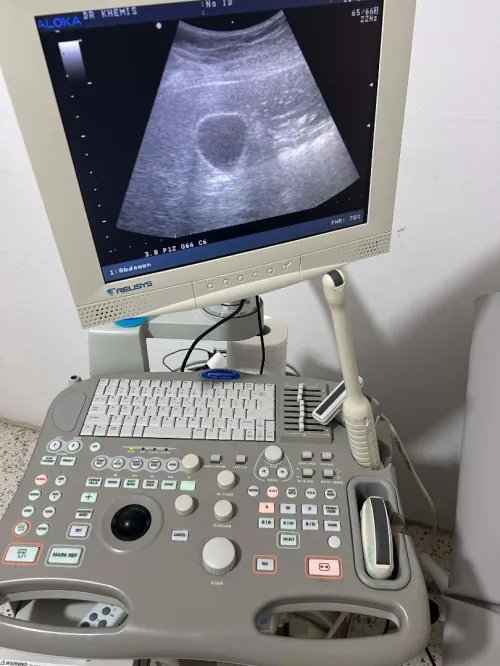 Echographe ALOKA ssd-3500