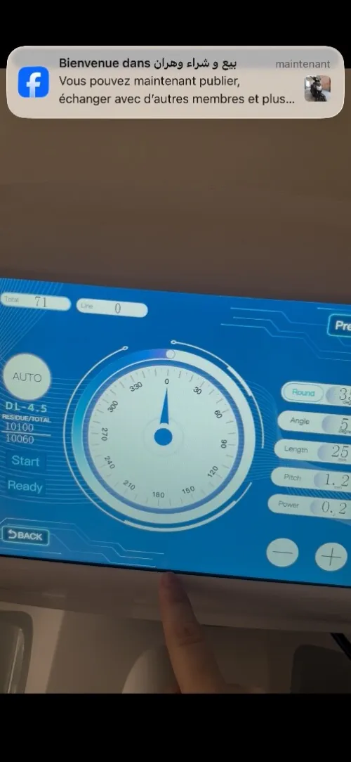 Hifu machine