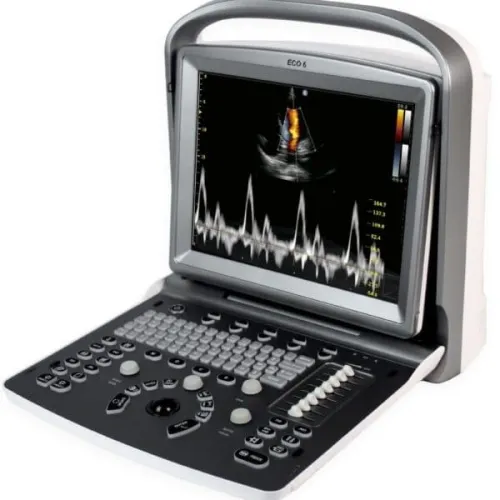 Echo Doppler Portatif CHISON ECO6