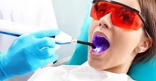 curing light