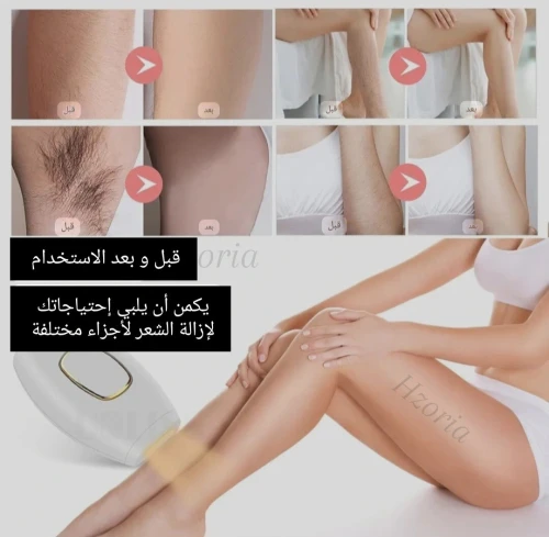 ipl pro original hair removal 1 million flashes