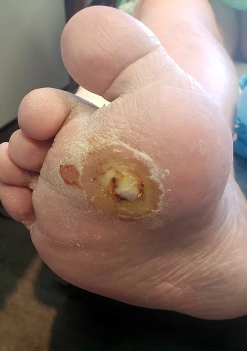 Traitement Chirurgical Ambulatorie  Lipome, Kyste, Ongle, Pied Diabétique