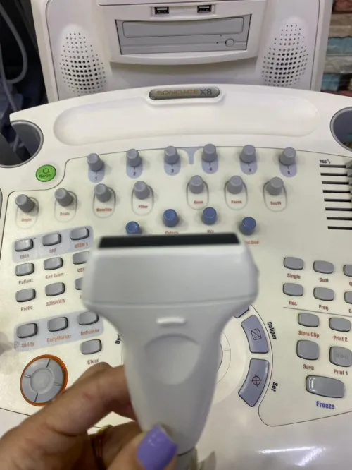 Échographe medison Sonoace X8 cardio