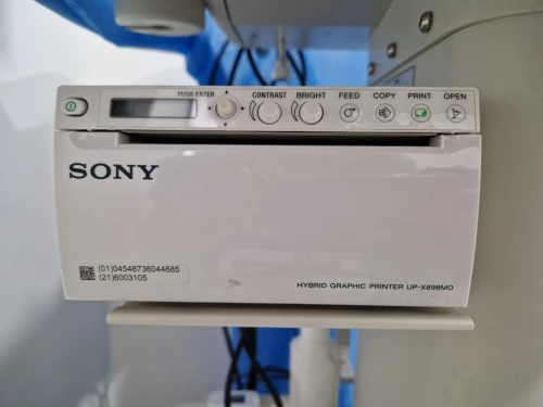ECHOGRAPHE SONOSCAPE A6 portatif
