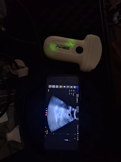 Échographie BMV MX5 en couleur 