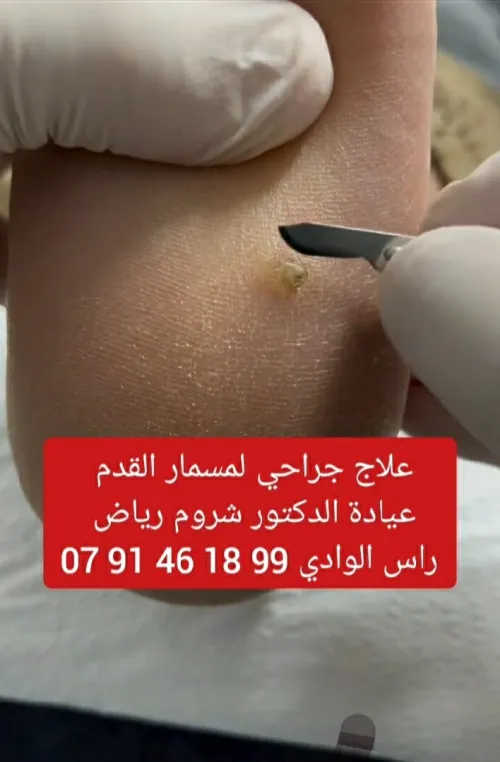 Podologie & petite chirurgie dermatologique