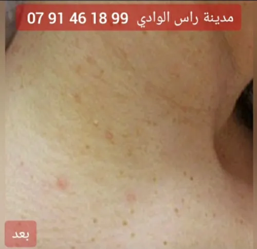 Podologie & petite chirurgie dermatologique