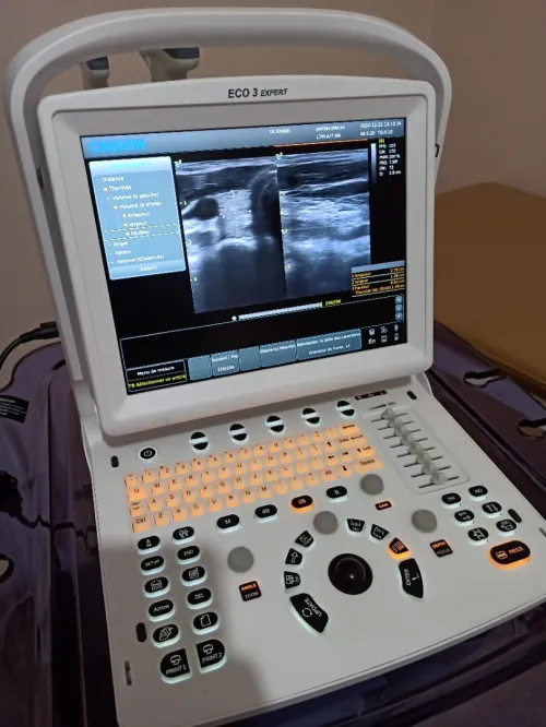 Échographe et ECG