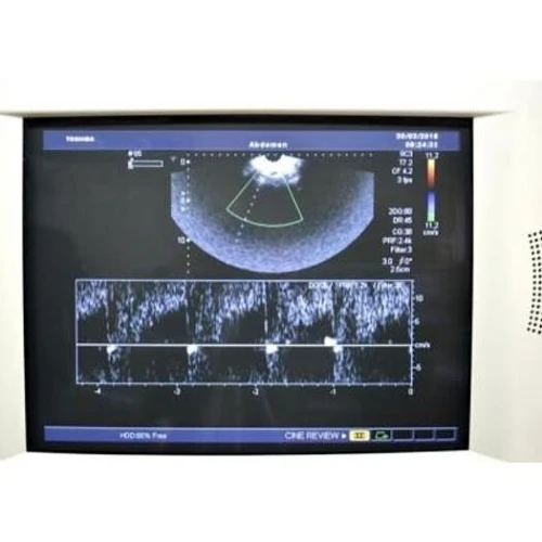Echographe TOSHIBA Aplio 80