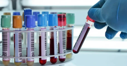 Logiciel de gestion des laboratoires d'analyses médicales