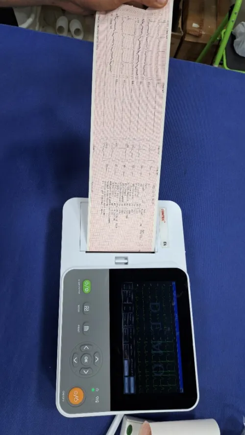 Electrocardiographe ECG Contec E6 (6 pistes) avec interprétation (Nouveau modèle)