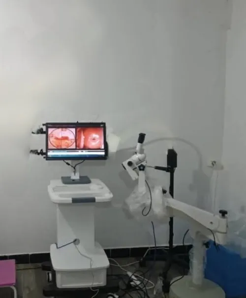 Colposcope a vendre