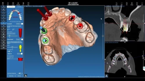 RealGuide 5.4 +Ai