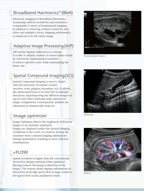 ECHOGRAPHE ALOKA ALPHA 6 