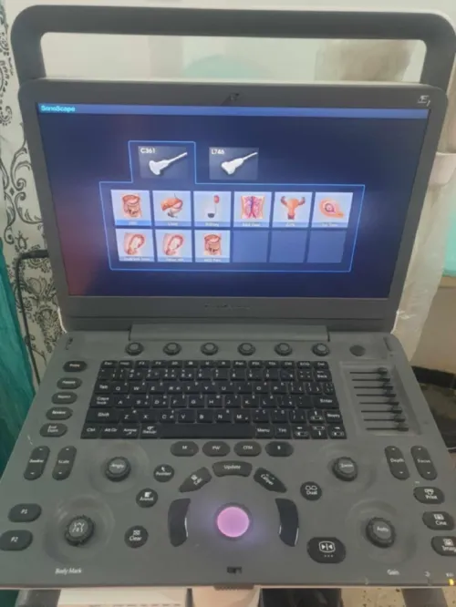 Echographe 