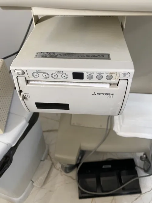 ECHOGRAPHE ALOKA SSD 1200