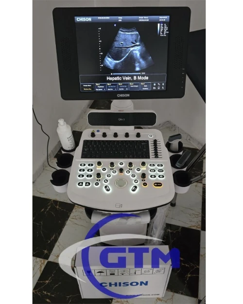 échographe échodoppler CHISON Q-BIT3