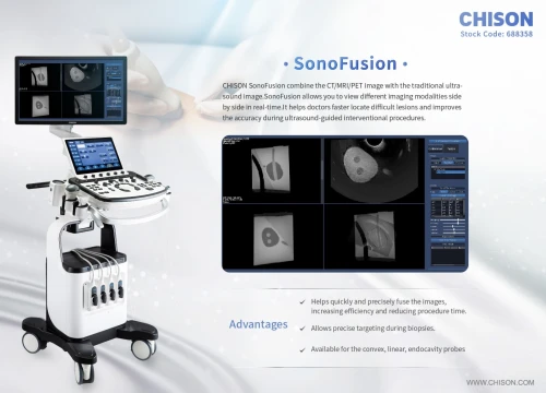 Echodoppler Couleur CHISON Xbit90