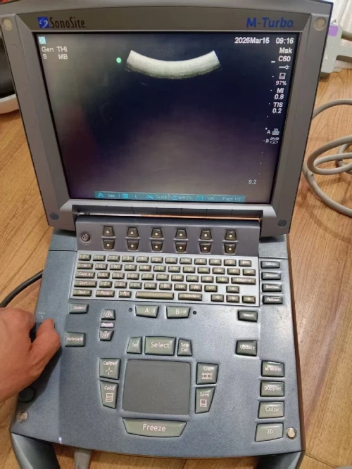 Echographe Sonosite m turbo