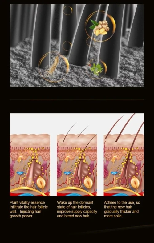 Anti chute cheveux solution miracle تساقط الشعر