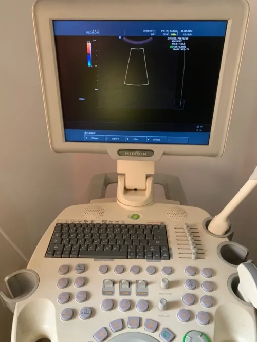 Échographie medison sonoace x6