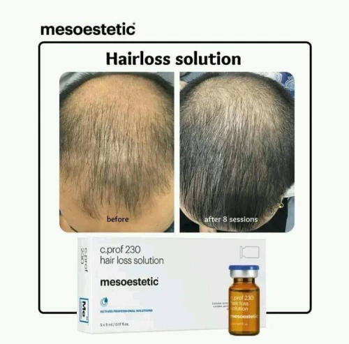 produits mesotherapie esthetique  dermo esthetique 